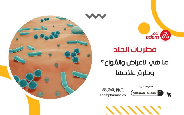 فطريات الجلد ما هي الأعراض والأنواع وطرق علاجها